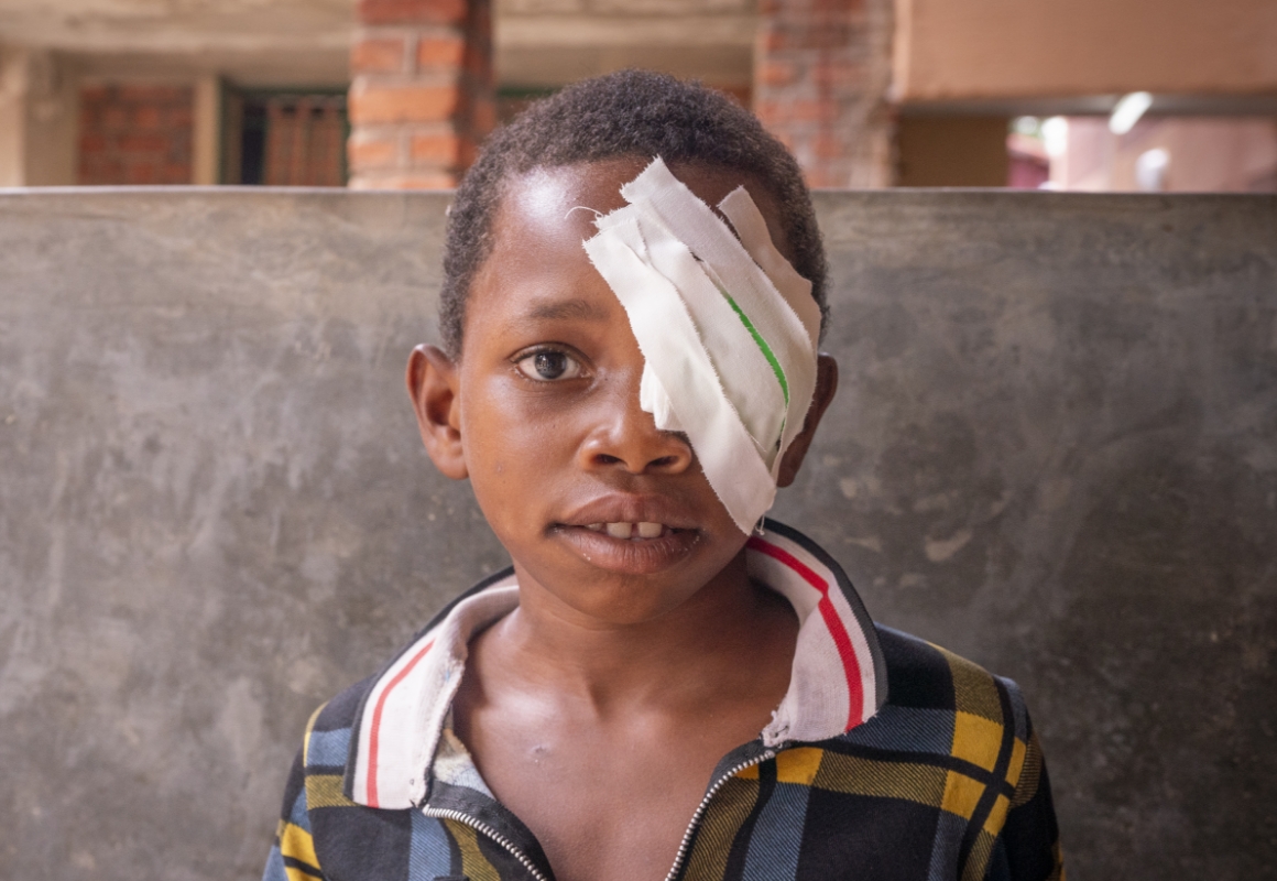 Justina, a young girl, looks directly at the camera wearing an eye patch over her left eye following cataract surgery.